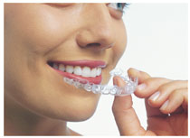 Invisalign-Adult-Holding-Aligner_sm